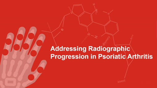 Radiographic Progression in Psoriatic Arthritis